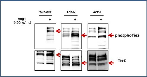 ACP-Tie2의 인산화 N-termninal 말단과, Ig3 domain의 N-terminal 부위에 tag된 ACP-Tie2가 Ang1에 의해 control보다 인산화되는 것을 확인할 수 있다