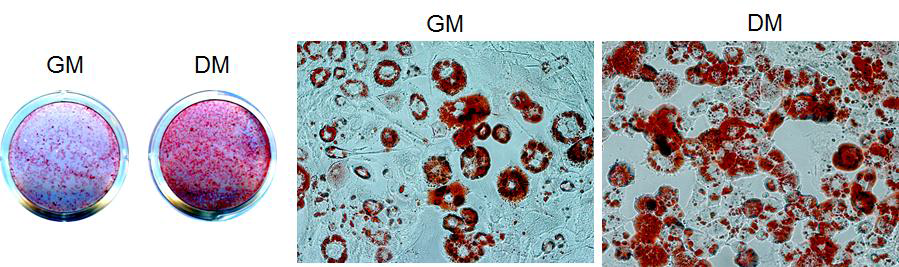 Oil red staining with differentiation media in 3T3-L1 cells.