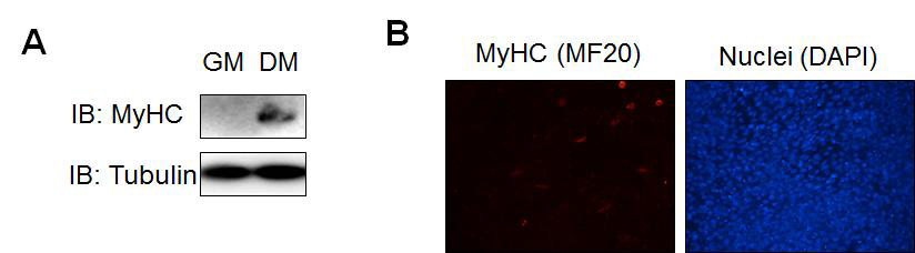 Expression of Myosin heavy chain (MyHC) during myoblast differentiation.