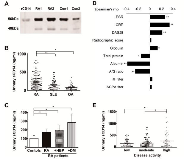 Predictive value of urinary sCD14 for the disease activity of RA