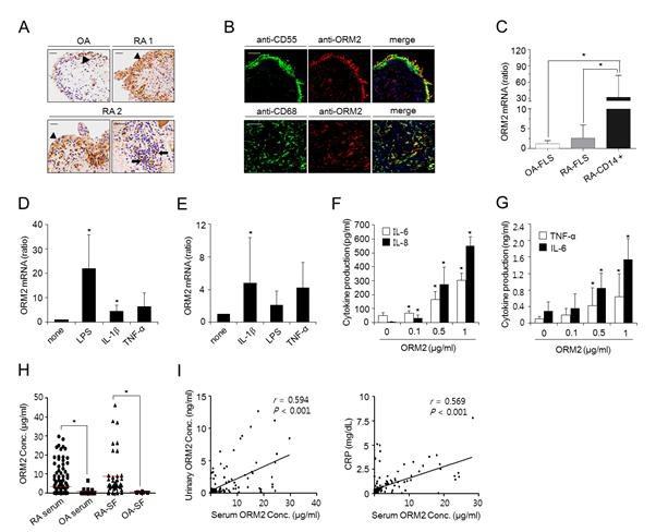 Expression of ORM2 in synovia, synovial cells, and synovial fluids of RA patients