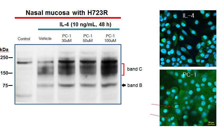 일차배양한 사람의 호흡기 상피세포에서 YS-PC1에 의한 H723R-펜드린 교정