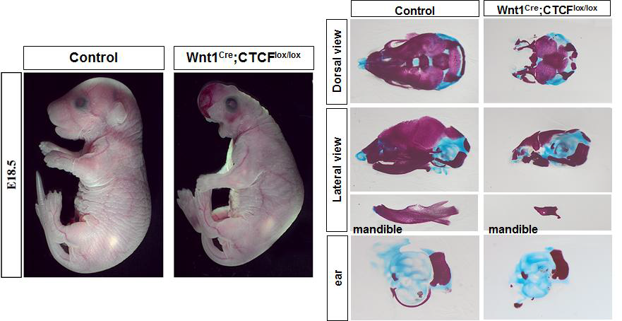 신경능선세포에서 CTCF를 결손시킨 마우스의 형태학적 변화 및 고막틀고리 (tympanic ring)의 결손