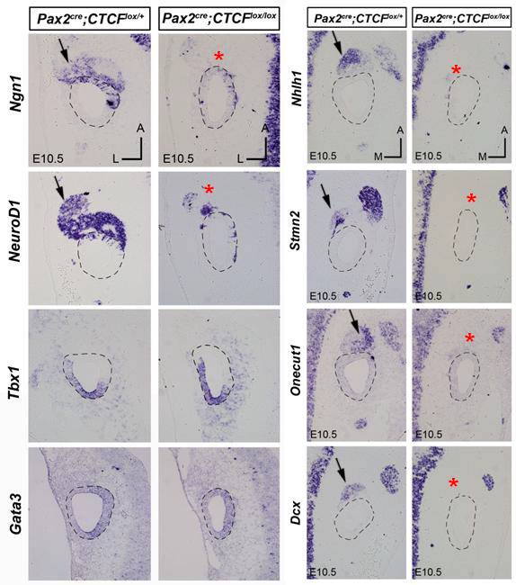 Microarray 분석과 RT-qPCR을 통해 검증된 후보 유 전자들의 조직 내 발현 양상 변화 를 확인하기 위해 in situ hybridization을 수행하여 최종 검 증하였음. 신경세포의 초기 분화 뿐 아니라 성숙단계에 요구되는 유전자들의 발현이 현저히 줄어들 어 있음을 확인할 수 있었음