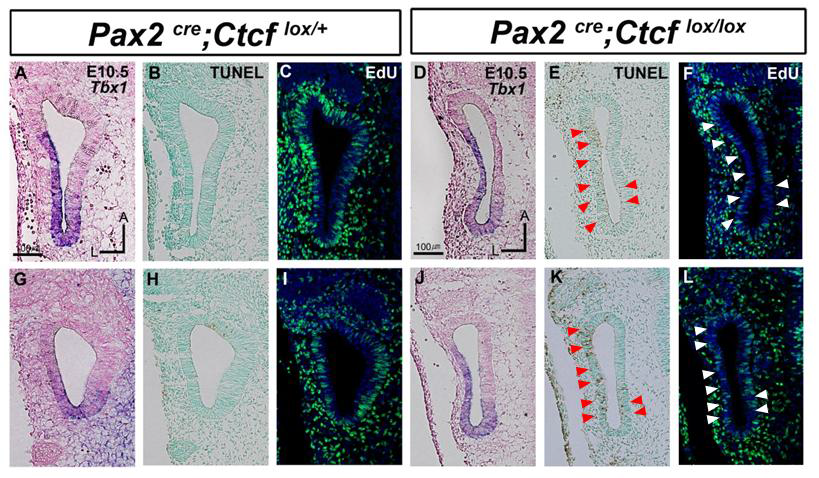 Pax2-Cre; CTCF-flox 마우스에서의 세포사멸과 세포 증식