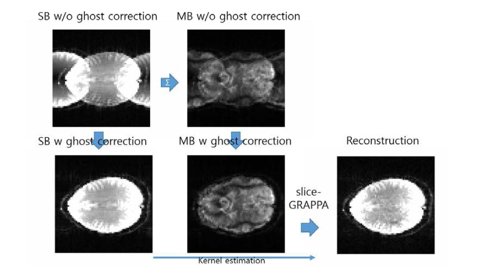 slice-GRAPPA를 이용한 EPI brain 영상의 복원 플로우와 결과 이미지. 고스트 correction 과정과 kernel estimation 과정으로 이루어져 있으며, reference scan이 필요 하다