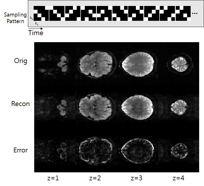 MB factor 4 경우에 대해 설계된 temporal incoherent sampling pattern(위), 샘플링 된 데 이터의 복원 결과(아래)