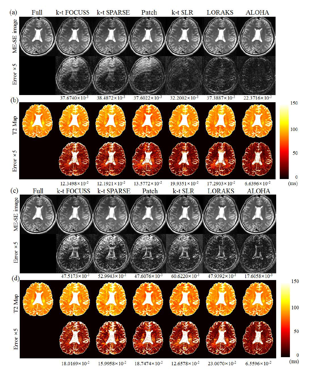 T2 parameter 영상의 고속화 복원 결과. 시뮬레이션 스터디로 형태의 다운샘플링 복원 결과(a,b)와 실제 고속화된 pulse sequence로 촬영된 데이터의 복원 결과(c,d)