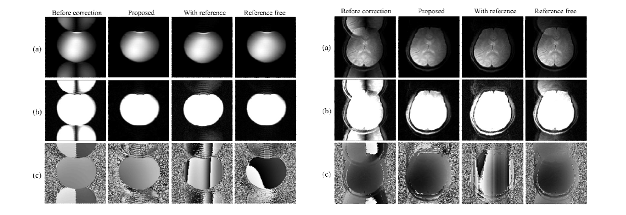 Spin-echo 기반 EPI의 고스트 아티팩트 제거 결과 (좌) phantom, (우) 실제 in-vivo 영상