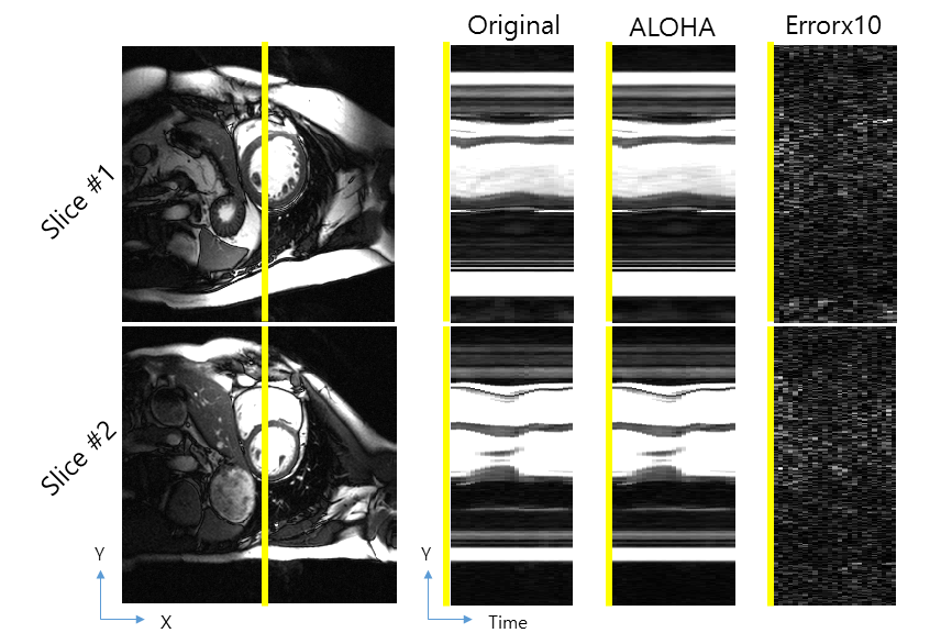 ALOHA를 이용한 심장 멀티밴드 영상 복원 결과. 시간축 단면 영상을 도시