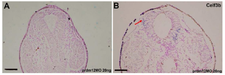 Prdm12 발현 차단 후 뇌 발생 영역의 ventralization