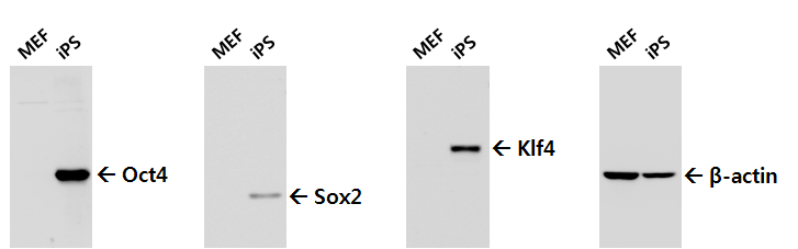 Western blot을 통한 iPS 세포의 stemness 단백질 발현 확인