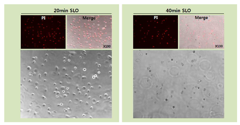 SLO 처리 시간에 따른 세포 모양 변화 양상