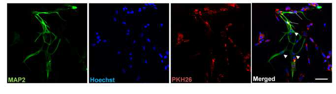 제대혈 유래 줄기세포를 이식하였을 때 PKH26의 발현 조사.