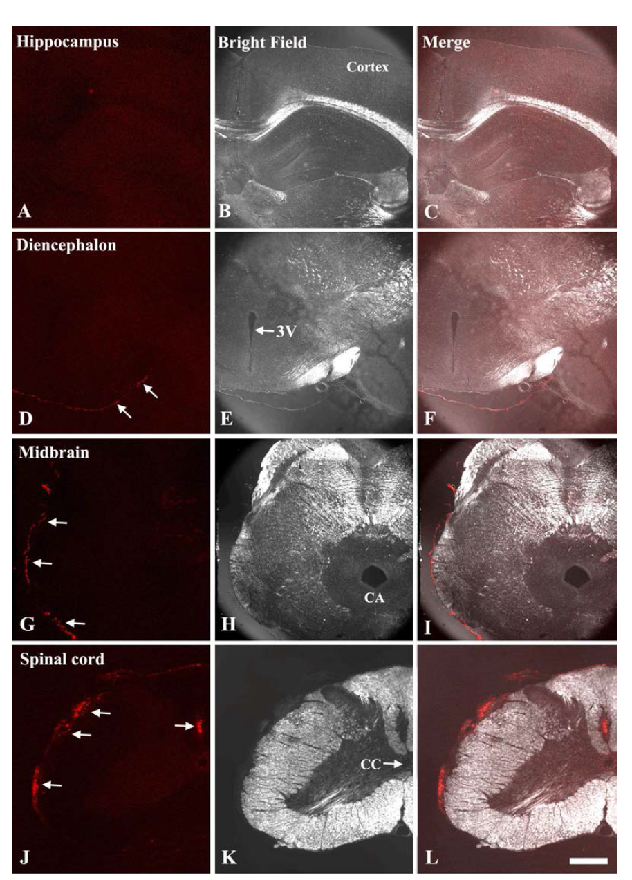 Immunofluorescence detection of CM-DiI labeled Ad-MSCs in the hippocampus (A-C), diencephalon (D-E), midbrain (G-H) and spinal cord (J-L).