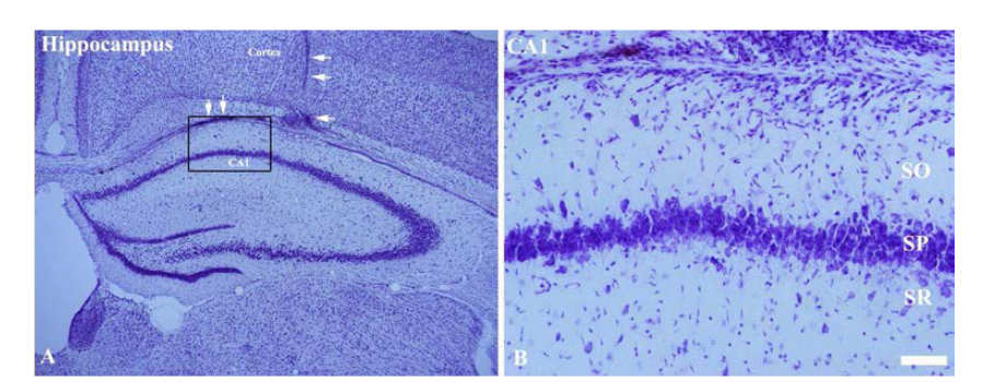 Cresyl violet staining. Arrows indicates region of transplanted MSCs location.