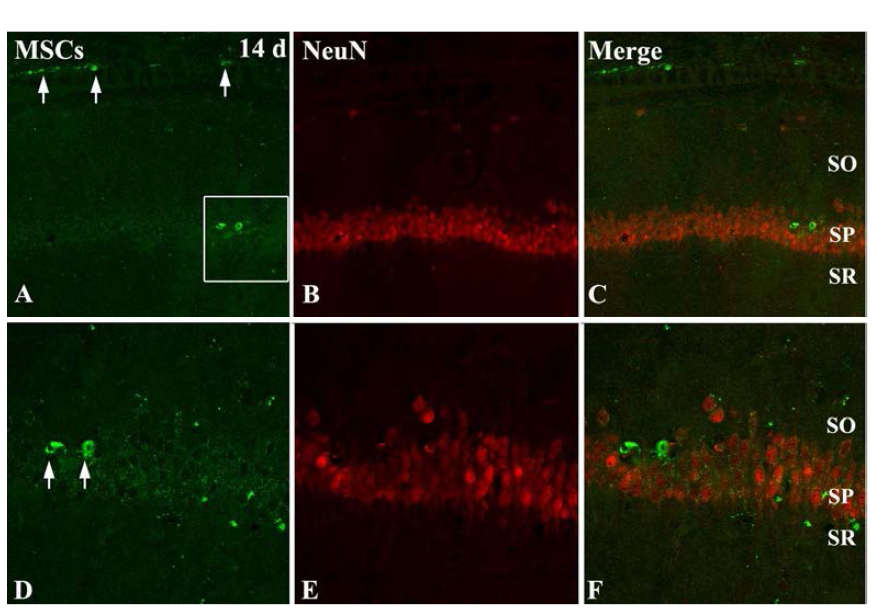 Double-immunohistofluorescent analysis for GFP and NeuN 14 days after transplantation in the hippocampal CA1. Arrows indicate GFP labeling MSCs.