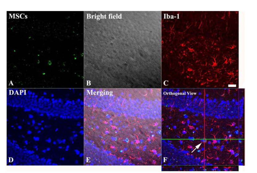 Differentiation of transplanted MSCs into astrocyte in the dendate gyrus(DG) of the aging ischemic model.