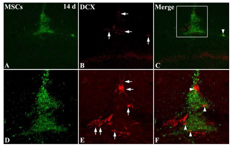 Double-immunohistofluorescent analysis for GFP and Doublecortin (DCX) 14 days after transplantation in the hippocampal CA1.