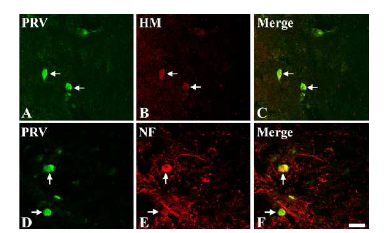 Confocal analysis shows that PRVs (A and D) are localized in both the HM positive cells (arrows, C) and NF positive cells (arrows, F) in the injured site of the rat spinal cord.