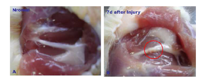 Gross anatomy of sciatic nerve in the normal and injured sciatic nerves.