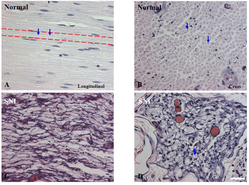 Histological analysis normal(A and B) and injured sciatic nerves(C and D) in the rat.