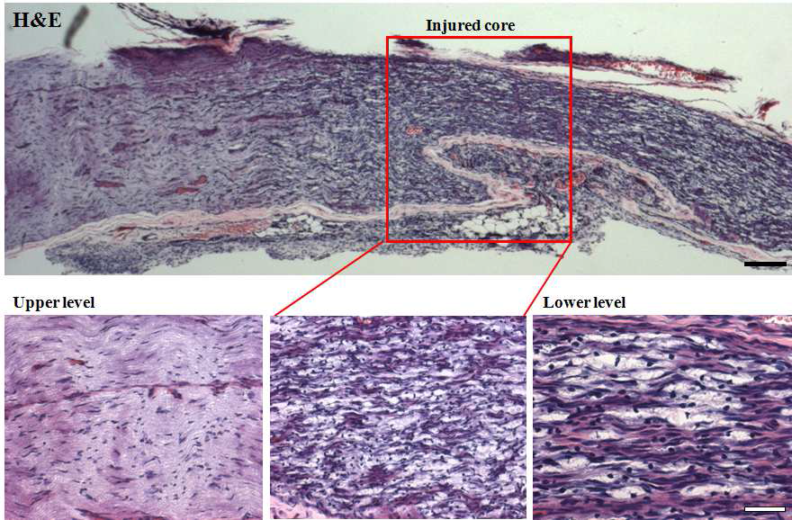 Histological analysis injured sciatic nerves 7 days after injury in the rat.