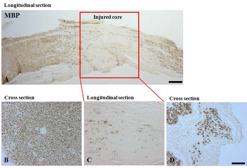 Immunohistochemical analysis of myelin basic protein (MBP) 7 days after sciatic nerve injury in the rat.