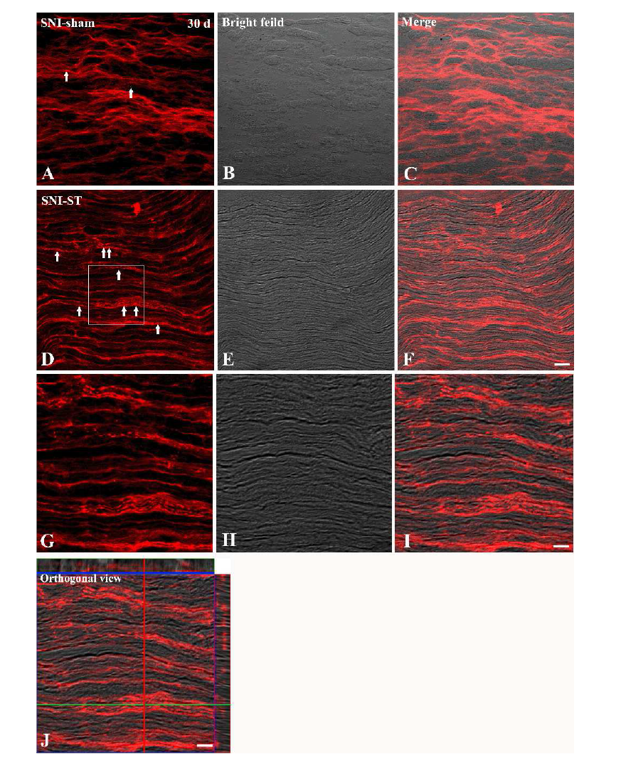 Immunohistochemistry for growth associated-protein 43 (GAP43) in the SNI-sham and SNI groups.