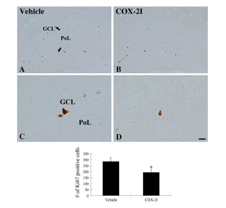 Microphotographs of Ki67 immunoreactivity in the dentate gyrus in vehicle- (A and C) and celecoxib-treated (B and D) groups.