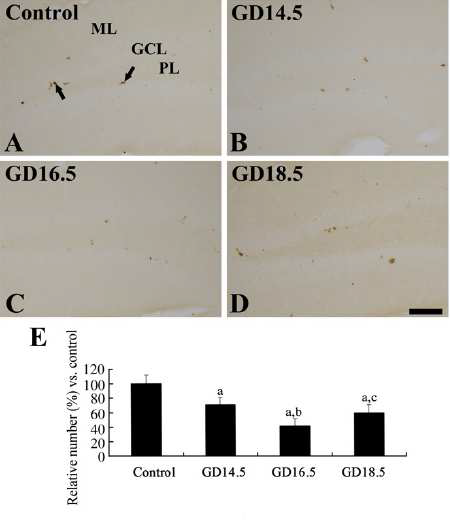 Representative microphotographs for Ki67 Immunohistochemistry in the DG in the age-matched control (A), GD14.5 (B), GD16.5 (C) and GD18.5 (D) group. Ki67+ cells (arrows) are detected in the DG in the control group.