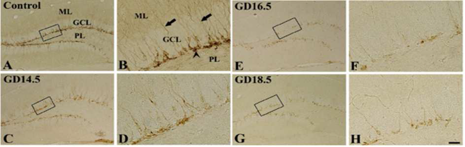 Representative microphotographs for DCX+ neuroblasts in the DG in the age-matched control (A and B), GD14.5 (C and D), GD16.5 (E and F) and GD18.5 (G and H) group.