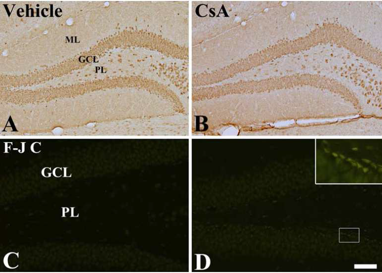Immunohistochemistry for NeuN and F-J B in the DG of the vehicle- (a, c) and CsA-treated (b, d) groups. GCL granule cell layer; ML molecular layer; PL polymorphic layer.