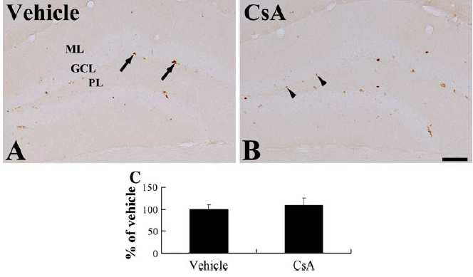 Immunohistochemistry for Ki67 in the DG of the vehicle- (a) and CsA-treated (b) groups. GCL granule cell layer; ML molecular layer; PL polymorphic layer.