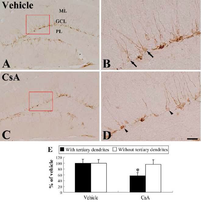 Immunohistochemistry for DCX in the SZDG of the vehicle- (a, b) and CsA-treated (c, d) groups.