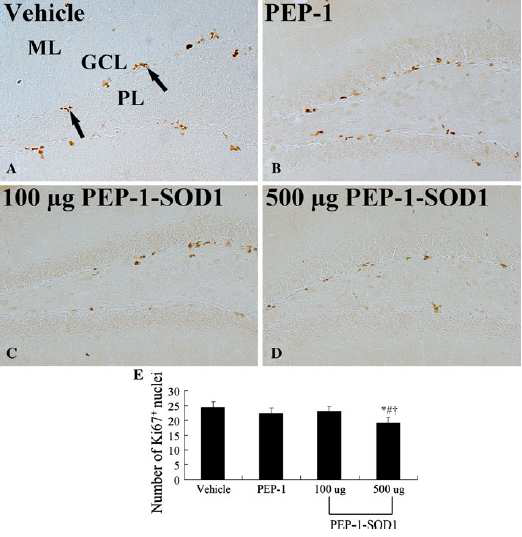 Immunohistochemistry for Ki67 in the DG of the vehicle- (a), PEP-1- (b), 100 LG (c), and 500 lg (d) PEP-1- SOD1-treated groups. Ki67-positive cells (arrows) are mainly detected in the SGZ. Ki67-positive cells are similar between the vehicleand PEP-1-treated groups.