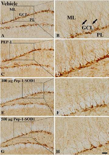Immunohistochemistry for DCX in the DG of the vehicle- (a, b), PEP-1- (c, d), 100 lg (e, f), and 500 lg (g, h) PEP-1-SOD1-treated groups. DCX-positive neuroblasts have well-developed dendrites (arrows) in the SGZ in the vehicle-treated group.
