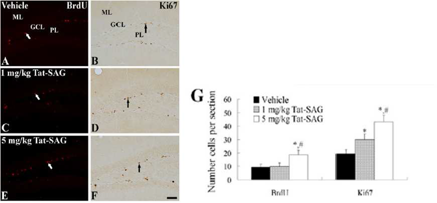 Immunohistochemistry for BrdU (a, c, e) and Ki67 (b, d, f) in the DG of the vehicle- (a, b), 1 mg/kg (c, d) and 5 mg/kg (e, f) Tat-SAG-groups. BrdU and Ki67 positive cells (arrows) are observed in the subgranular zone. BrdU positive cells are more abundant in 5 mg/kg Tat-SAG-groups than the vehicle-group, while Ki67 positive cells are more abundant in the 1 and 5 mg/kg Tat-SAG-groups than the vehicle-group.