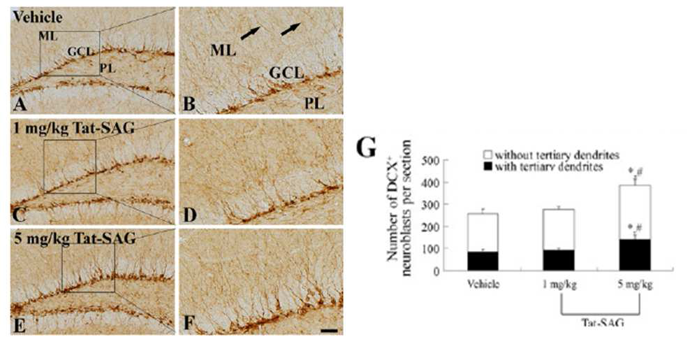 DCX immunohistochemistry in the DG of the vehicle- (a, b), 1 mg/kg (c, d) and 5 mg/kg (e, f) Tat-SAG-groups.