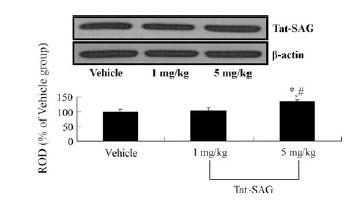 Western blot analysis of DCX in the DG of the vehicle-, and 5 mg/kg Tat-SAT-treated groups.