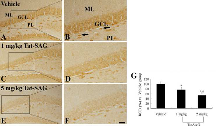 4-HNE immunohistochemistry in the DG of the vehicle- (a, b), 1 mg/kg (c, d) and 5 mg/kg (e, f) Tat-SAG-groups.