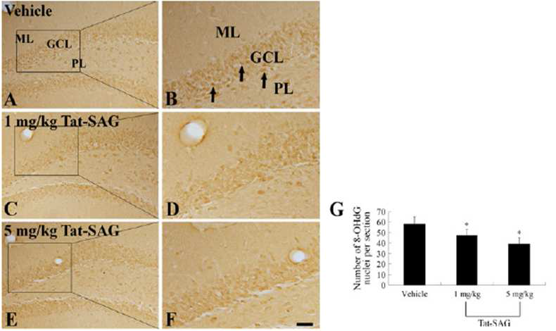 Immunohistochemistry for 8-OHdG in the DG of the vehicle-(a, b), 1 mg/kg (c, d) and 5 mg/kg (e, f) GCL granule cell layer, ML molecular layer, PL polymorphic layer.