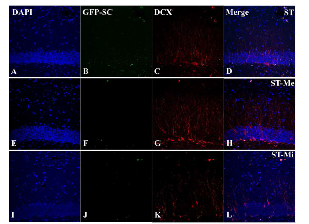 Differentiation of transplanted mesenchymal stem cell into double immunoreactive neuroblast 30 days after ischemia-reperfusion in the aging gerbi.