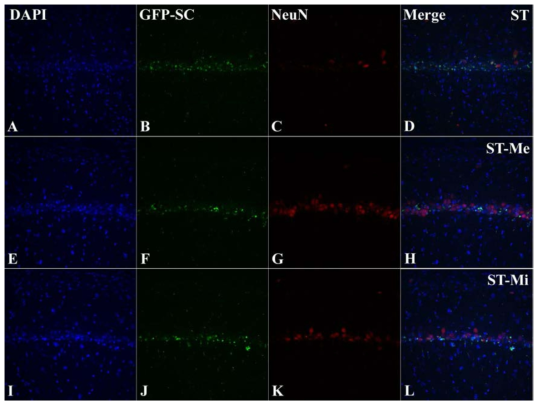 Differentiation of transplanted mesenchymal stem cell(GFP-SC) into Neuron
