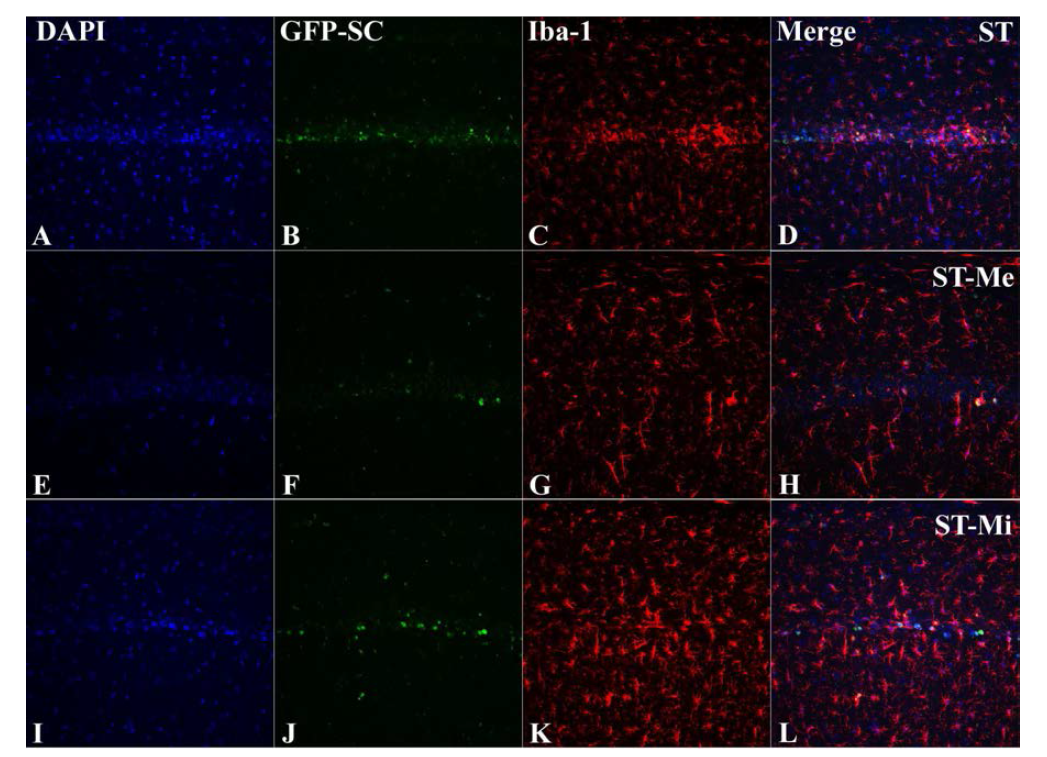 Differentiation of transplanted mesenchymal stem cells (GFP-SC) into microglia (iba-1) in the hippocampal CA1 region 30 days after ischemia-reperfusion in the aging gerbil.