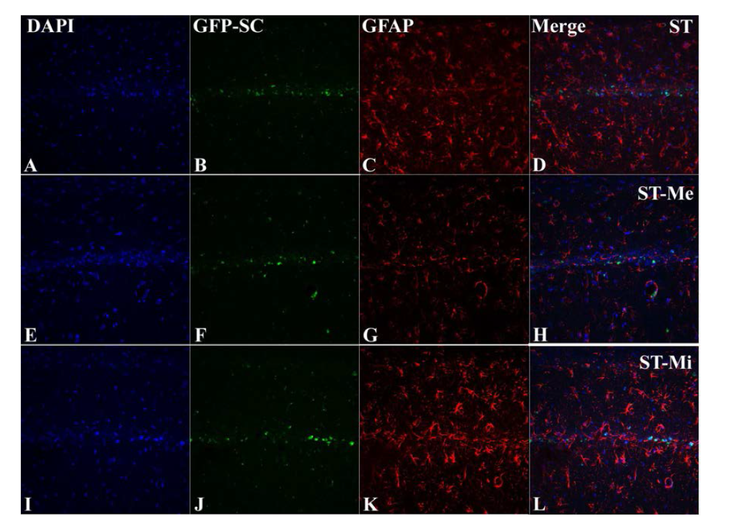 Differentiation of transplanted mesenchymal stem cell(GFP-SC) into astrocytes (GFAP) in the hippocampal CA1 region 30 days after ischemia-reperfusion in the aging gerbil.