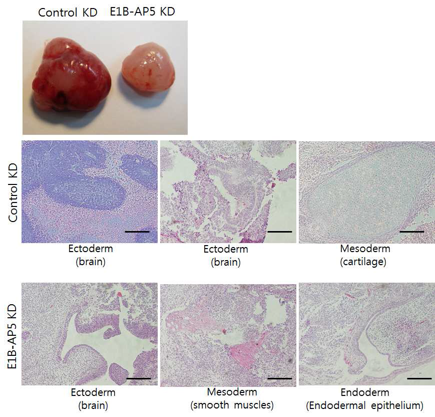 NOD/SCID 생쥐 정소에 control또는 E1B-AP5 knockdown H9세포를 주사하 여 teratoma형성르 관찰하니 E1B-AP5 KD에서 현저하게 teratoma가 작던지 생긱지 않았다 (위). 아래는 teratoma를 잘라서 삼배엽성 조직을 관찰한 것이다.