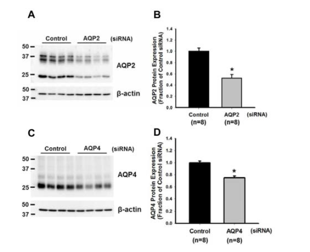 dDAVP-9R과 siRNA complex를 이용한 쥐의 신장 속수질 집합관에서의 AQP2 또는 AQP4의 단백 발현 조절 실험의 결과