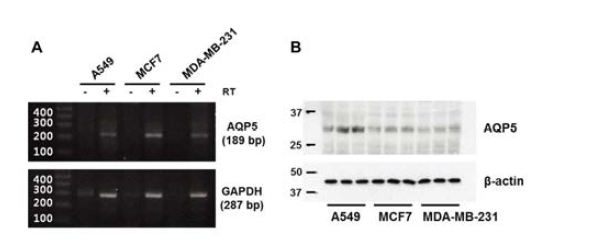 유방암 세포주인 MCF-7 세포에서의 AQP5 의 mRNA (A)와 단백질 (B) 발현 확인.