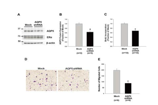 MCF-7 세포에서 Lentivirus를 이 용한 AQP5의 단백발현 저해와 AQP5가 저해된 세포의 세포 증식 및 전이성 검 사.